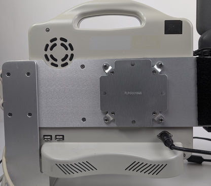 BARD Site-Rite 6 (9770066) Ultrasound System w/Tablet, Probe, and Power Unit